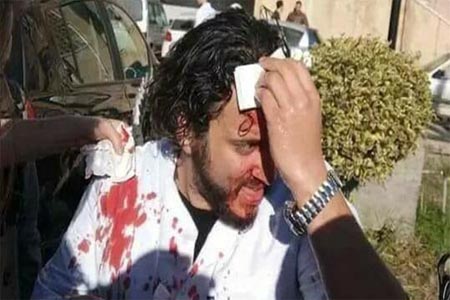 أحد الجرحى إثر اشتباكات بين الأطباء والأمن بالجزائر