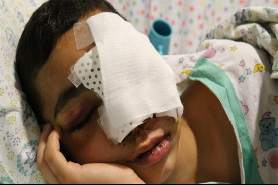 الطفل المقدسي العامودي ضحية جديدة للرصاص الإسفنجي