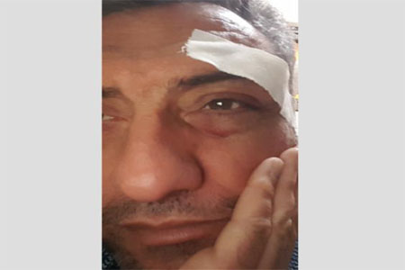 الصحفي محمد البابا بعد الاعتداء عليه اثناء تغطيته المسيرة في غزة